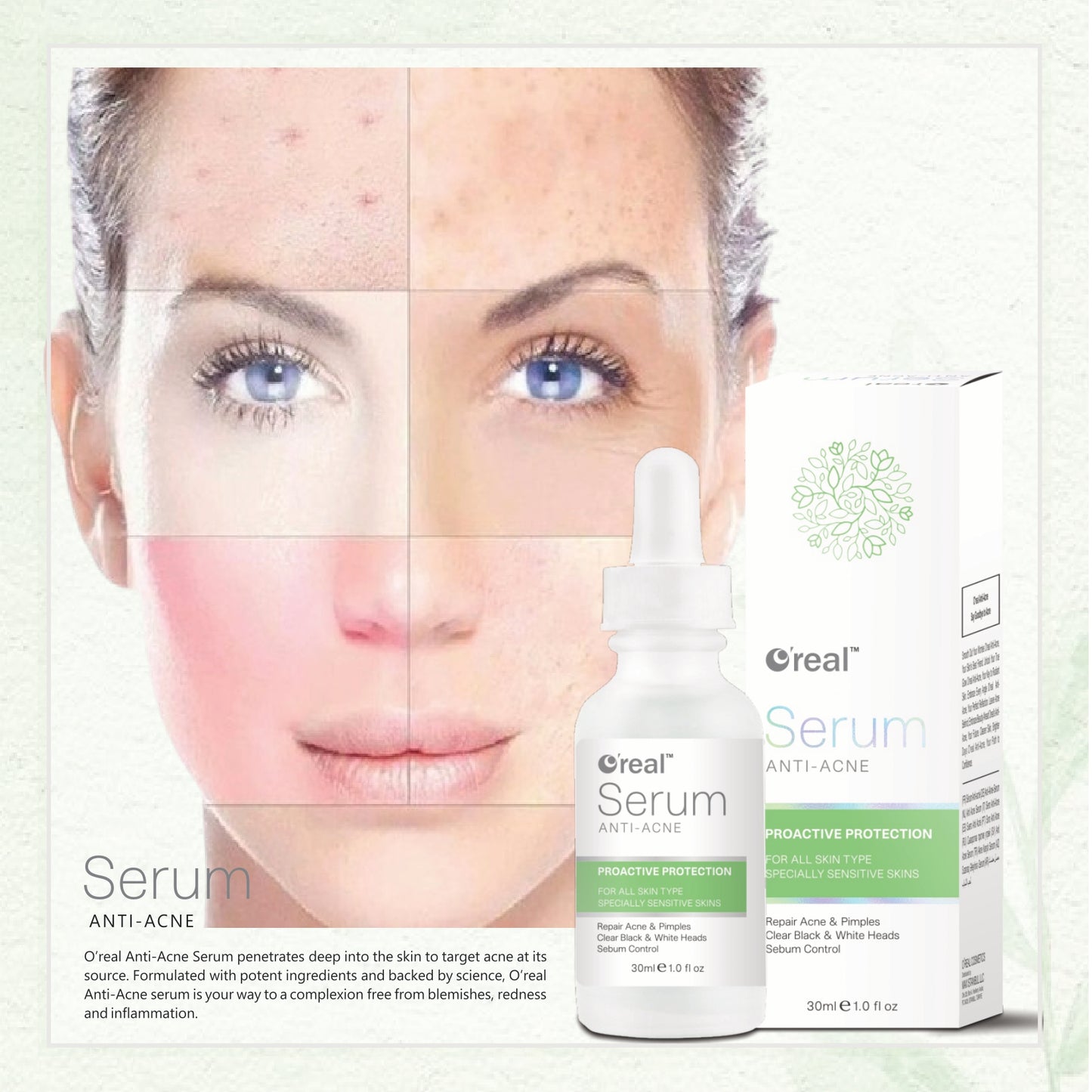 Anti Acne Serum